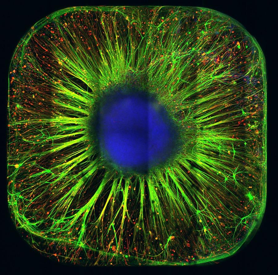 Organoid, czyli mini-mózg wyhodowany w laboratorium Grupy Badawczej Mechanizmów Neurodegeneracji w Łukasiewicz – PORT. Fot. Łukasiewicz – PORT