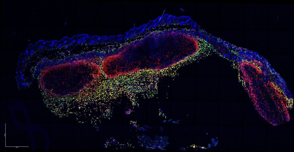 Mikroskopia fluorescencyjna przekroju tkanki z czerwonymi, zielonymi i niebieskimi markerami komórkowymi.