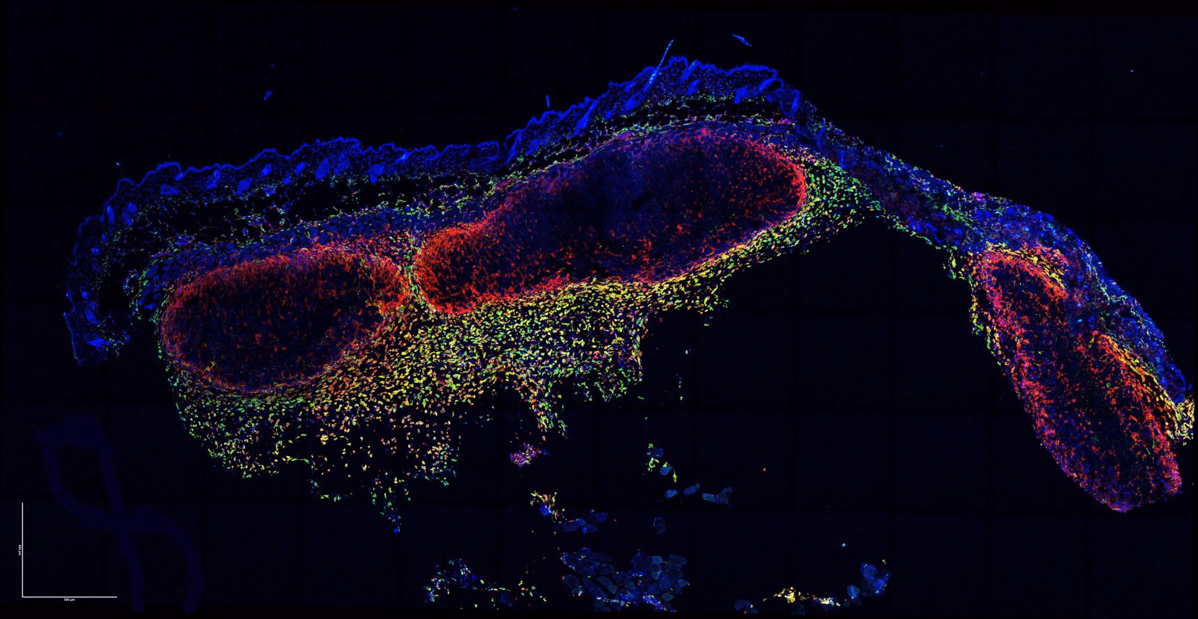 Mikroskopia fluorescencyjna przekroju tkanki z czerwonymi, zielonymi i niebieskimi markerami komórkowymi.